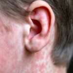 Health officials report measles exposure at Phoenix Sky Harbor International Airport