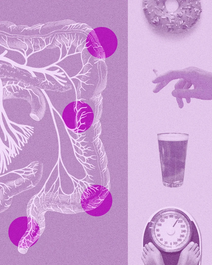 2Well-Colorectal-Cancers-superJumbo (Healthguidancehub)